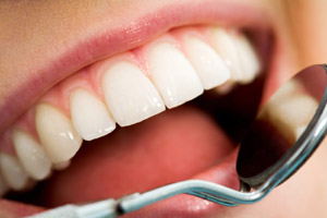 Dépistage en orthodontie Tassin 